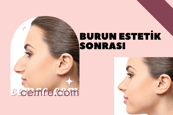 Burun Estetik Sonrası