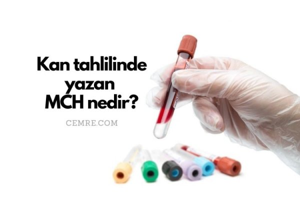 Kan tahlilinde yazan MCH nedir? MCH aralığı kaç olmalı?