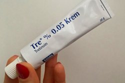 Tre krem ne işe yarar? Tre krem nasıl kullanılır?